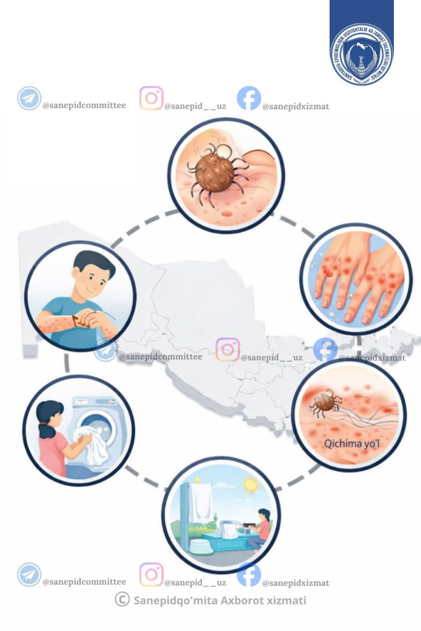TERI OSTIDAGI KO‘RINMAS DUSHMAN  - QICHIMA HAQIDA NIMALARNI BILISH KERAK?